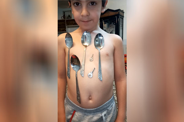 چسبیدن اجسام آهنی به بدن پسر بچه برخواری! + فیلم