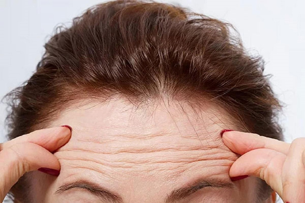 هشدار؛ چروک‌های صورت از یک بیماری مرگبار خبر می‌دهند